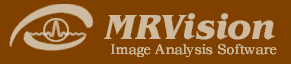 ロゴ：MRVision社