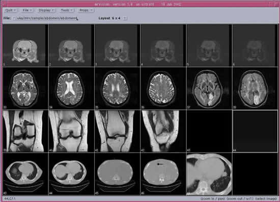 画像：異なる画像ファイルの同時表示