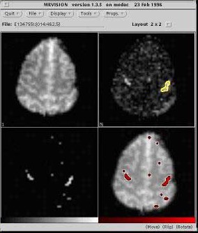 画像：統計処理の適用